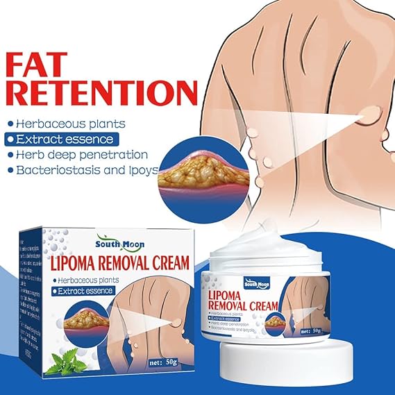 Lipoma Removal Cream (100% effective) Imported Formula