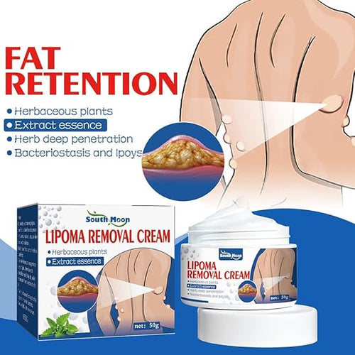 Lipoma Removal Cream (100% effective) Imported Formula